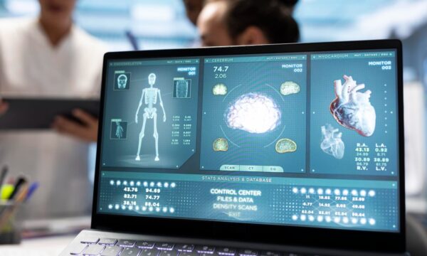 IA e remuneração médica: o erro do nobel Geoffrey Hinton sobre o fim da radiologia