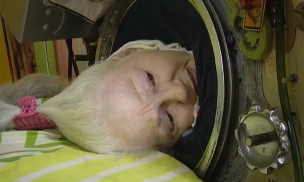 Mulher que viveu mais de 70 anos em ‘pulmão de aço’ morre nos Estados