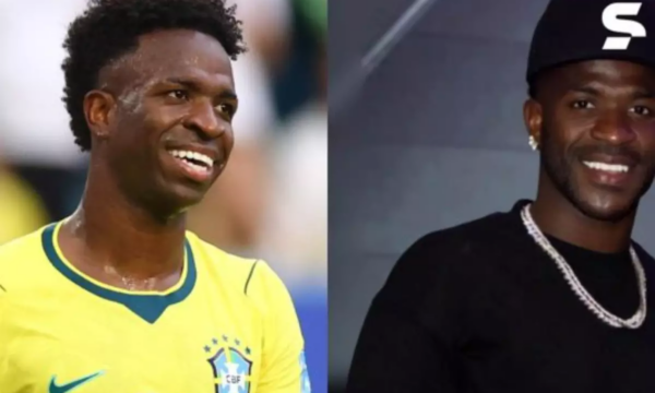 Vini Jr. fez harmonização facial? Especialistas explicam o que mudou no rosto do jogador