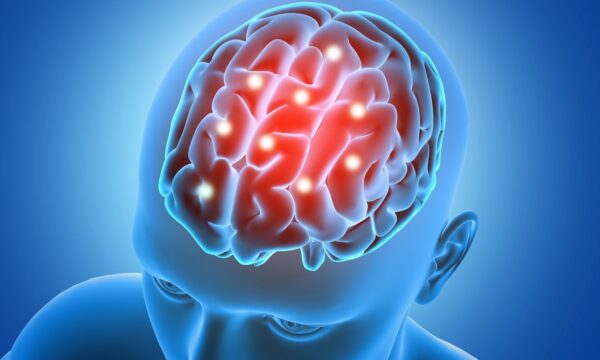 Câncer cerebral: nanopartículas podem revelar células que a cirurgia não encontra