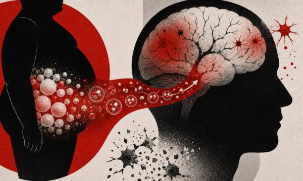 Como a obesidade pode aumentar o risco de Alzheimer, segundo novo estudo