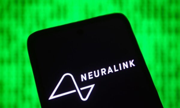 ‘Eu te amo’: usuário de implante cerebral usa só o pensamento para falar com quem ama