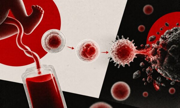 Sangue do cordão umbilical vira ‘arma’ contra o câncer em novo estudo