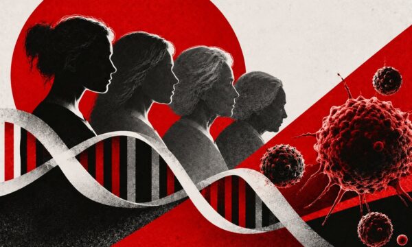 Câncer cresce entre jovens — envelhecimento acelerado pode ajudar a ex