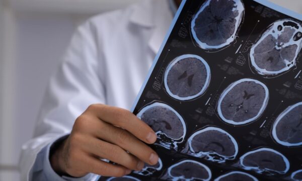 Mulher faz quimioterapia por 11 anos até descobrir que nunca teve cânc