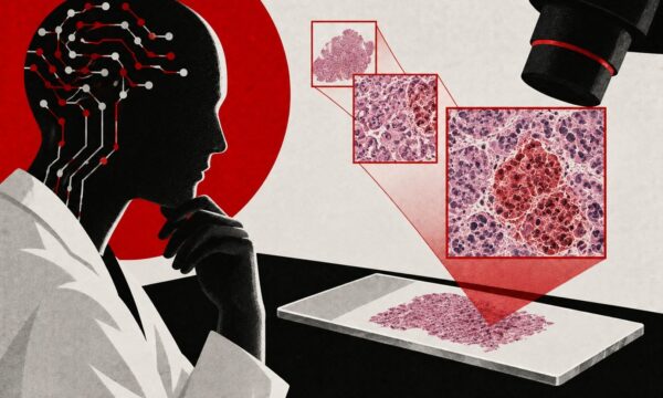 IA aprende a ‘pensar’ como médicos e melhora busca por câncer, mostra