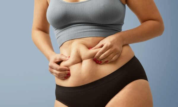 Obesidade pode deixar ‘memória’ no sistema imunológico por anos, revel