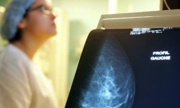 Planos de saúde serão obrigados a cobrir mamografia digital para todas as idades e gêneros