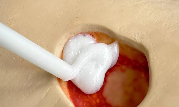 Cientistas criam espuma injetável que pode ajudar a evitar amputações;