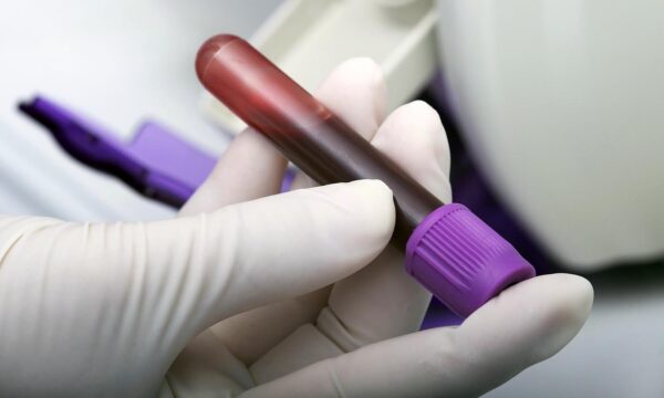 Novo exame de sangue que detecta sinais de 50 tipos de câncer chega ao Brasil